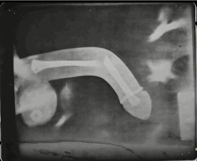 Scary X-ray